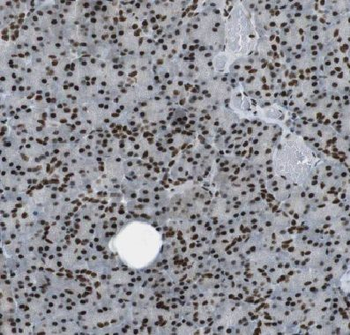 COPS4 Rabbit Polyclonal Antibody