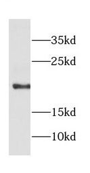 COPZ1 Rabbit Polyclonal Antibody