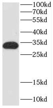 COQ4 Rabbit Polyclonal Antibody