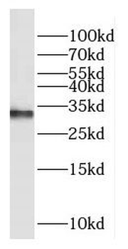 COX11 Rabbit Polyclonal Antibody