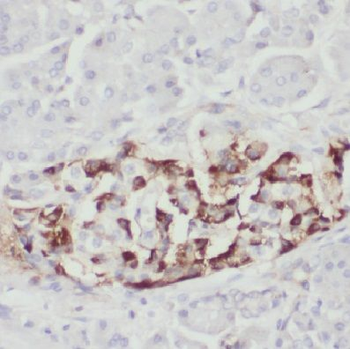 COX11 Rabbit Polyclonal Antibody