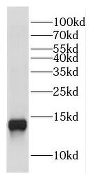 COX16 Rabbit Polyclonal Antibody