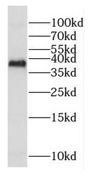 COX18 Rabbit Polyclonal Antibody