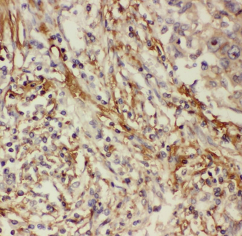 PTGS2 Rabbit Polyclonal Antibody
