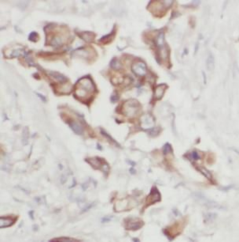 COX5A Rabbit Polyclonal Antibody