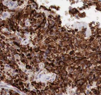 COX7A1 Rabbit Polyclonal Antibody
