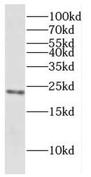 COX7C Rabbit Polyclonal Antibody
