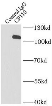 CCP110 Rabbit Polyclonal Antibody