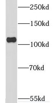 CCP110 Rabbit Polyclonal Antibody