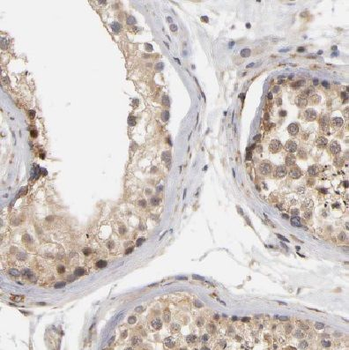 CCP110 Rabbit Polyclonal Antibody
