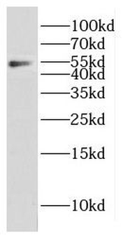 CPEB1 Rabbit Polyclonal Antibody