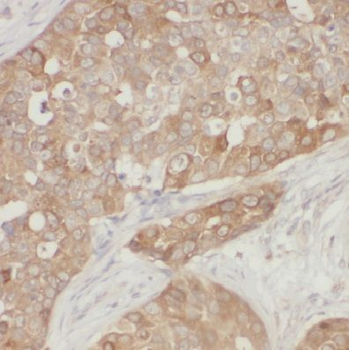 CPEB1 Rabbit Polyclonal Antibody
