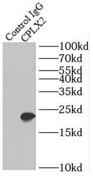 CPLX2 Rabbit Polyclonal Antibody