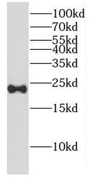 CPLX2 Rabbit Polyclonal Antibody
