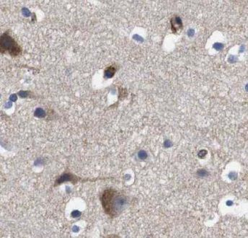 CPLX2 Rabbit Polyclonal Antibody