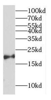 CPLX2 Rabbit Polyclonal Antibody