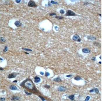 CPLX2 Rabbit Polyclonal Antibody