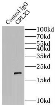 CPLX3 Rabbit Polyclonal Antibody