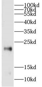 CPLX3 Rabbit Polyclonal Antibody