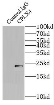 CPLX4 Rabbit Polyclonal Antibody