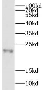 CPLX4 Rabbit Polyclonal Antibody