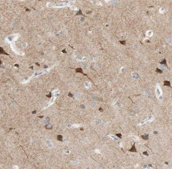 CPLX4 Rabbit Polyclonal Antibody