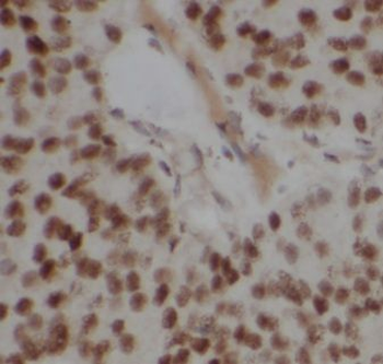 CPNE3 Rabbit Polyclonal Antibody