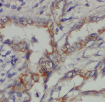 CPNE8 Rabbit Polyclonal Antibody