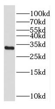 CPPED1 Rabbit Polyclonal Antibody