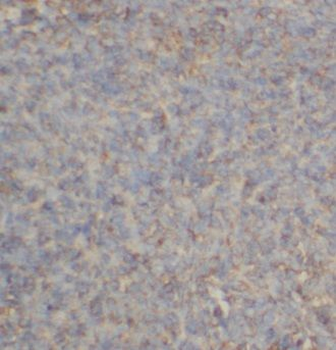 CPPED1 Rabbit Polyclonal Antibody