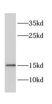 CRABP1 Rabbit Polyclonal Antibody