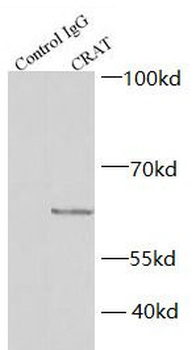 CRAT Rabbit Polyclonal Antibody