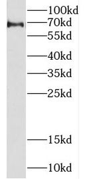 CREBZF Rabbit Polyclonal Antibody