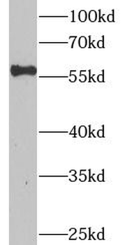 CRHR2 Rabbit Polyclonal Antibody