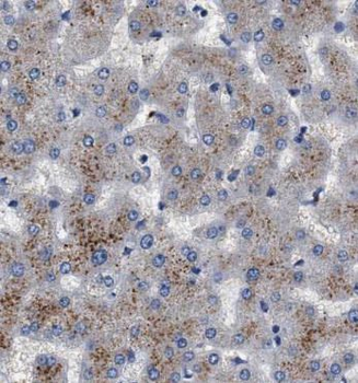 CRHR2 Rabbit Polyclonal Antibody