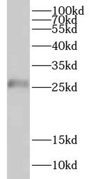 CRISP2 Rabbit Polyclonal Antibody