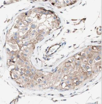 CRISP2 Rabbit Polyclonal Antibody