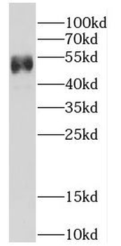 CRLS1 Rabbit Polyclonal Antibody