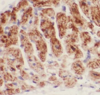 CRLS1 Rabbit Polyclonal Antibody