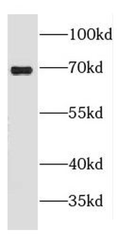 CROT Rabbit Polyclonal Antibody