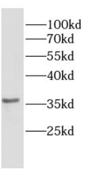 CRX Rabbit Polyclonal Antibody
