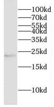 CRYBA2 Rabbit Polyclonal Antibody