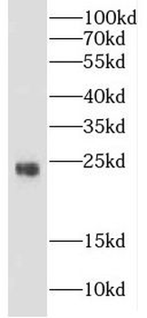 CRYBB3 Rabbit Polyclonal Antibody