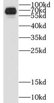 CRY1 Rabbit Polyclonal Antibody