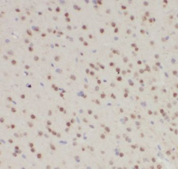 CRY1 Rabbit Polyclonal Antibody