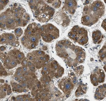 CSAD Rabbit Polyclonal Antibody
