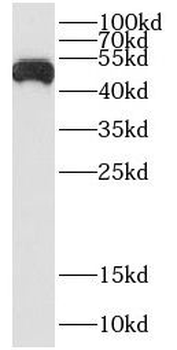CSF2RA Antibody