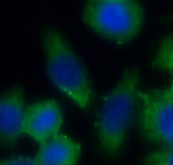 CSNK2A1 Rabbit Polyclonal Antibody