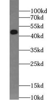 CSNK2A1 Rabbit Polyclonal Antibody