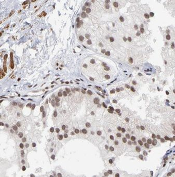 CSTF2T Rabbit Polyclonal Antibody
